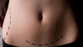 Expectativa sobre cirurgia plástica deve ser discutida com médico