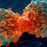 Dieta cetogênica e câncer