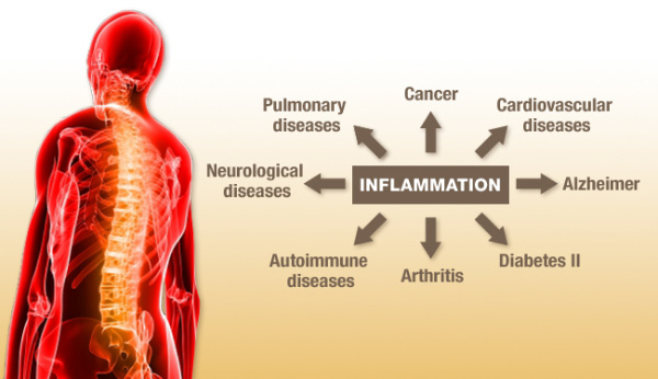 Inflammation