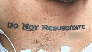 Homem com tatuagem “não ressuscite” deixa médicos em conflito ético