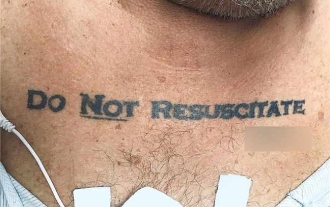 Tatuagem pedia que o paciente não fosse reanimado%3A 