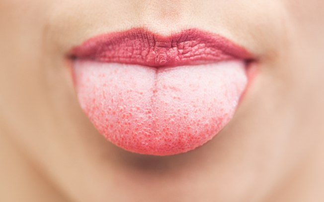 Uma língua saudável deve ser rosa ou vermelho claro, com um leve revestimento branco