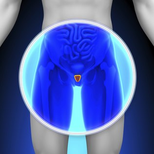 O câncer de próstata é o mais frequente entre os homens