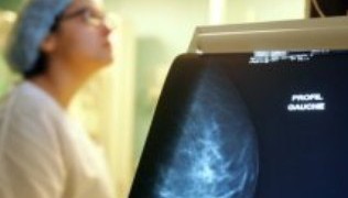 Mastologistas pedem programa de qualidade de mamografias