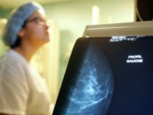 Menos de 10% das 5,2 mil clínicas públicas e privadas existentes no País têm o selo de qualidade em mamografia 