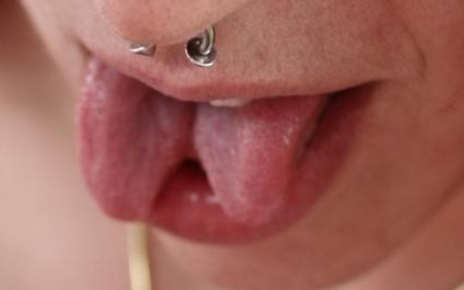 Língua bifurcada ou tongue splitting é a prática que consiste em cortar a língua ao meio